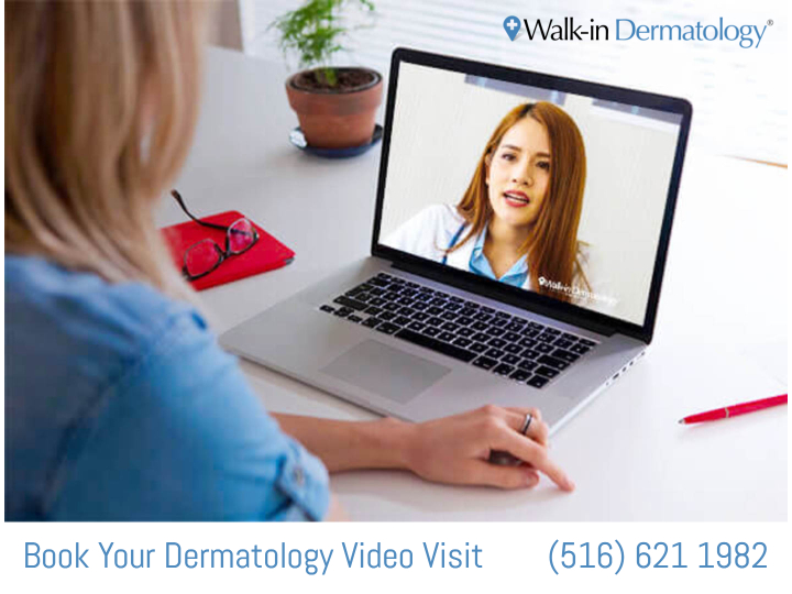 video visit with a dermatologist