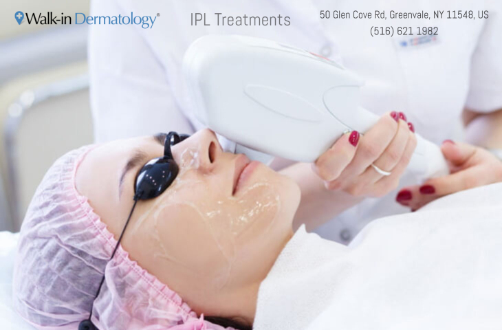 IPL treatment female patient