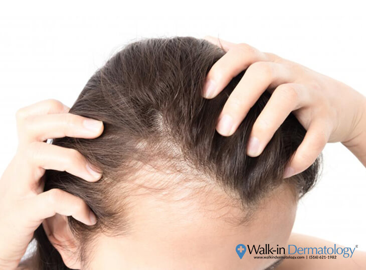 Walk-in Dermatology - Covid-19 Hair Loss May Be Side Effect of Viral  Infection