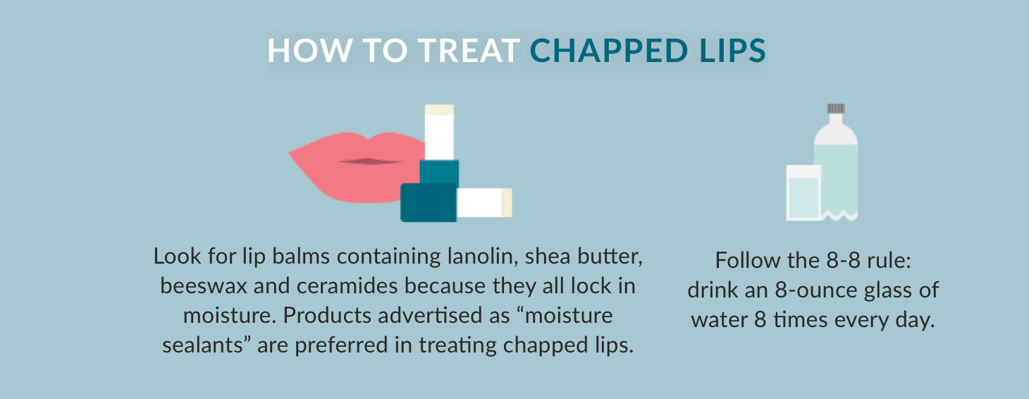 How to Treat Chapped Lips