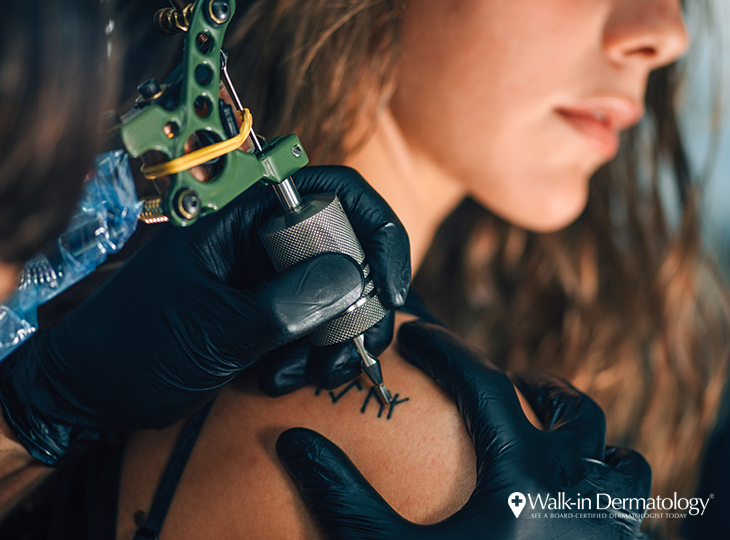 Walk-in Dermatology - That Tattoo Could Spell Trouble