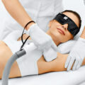 A woman getting a laser hair removal treatment